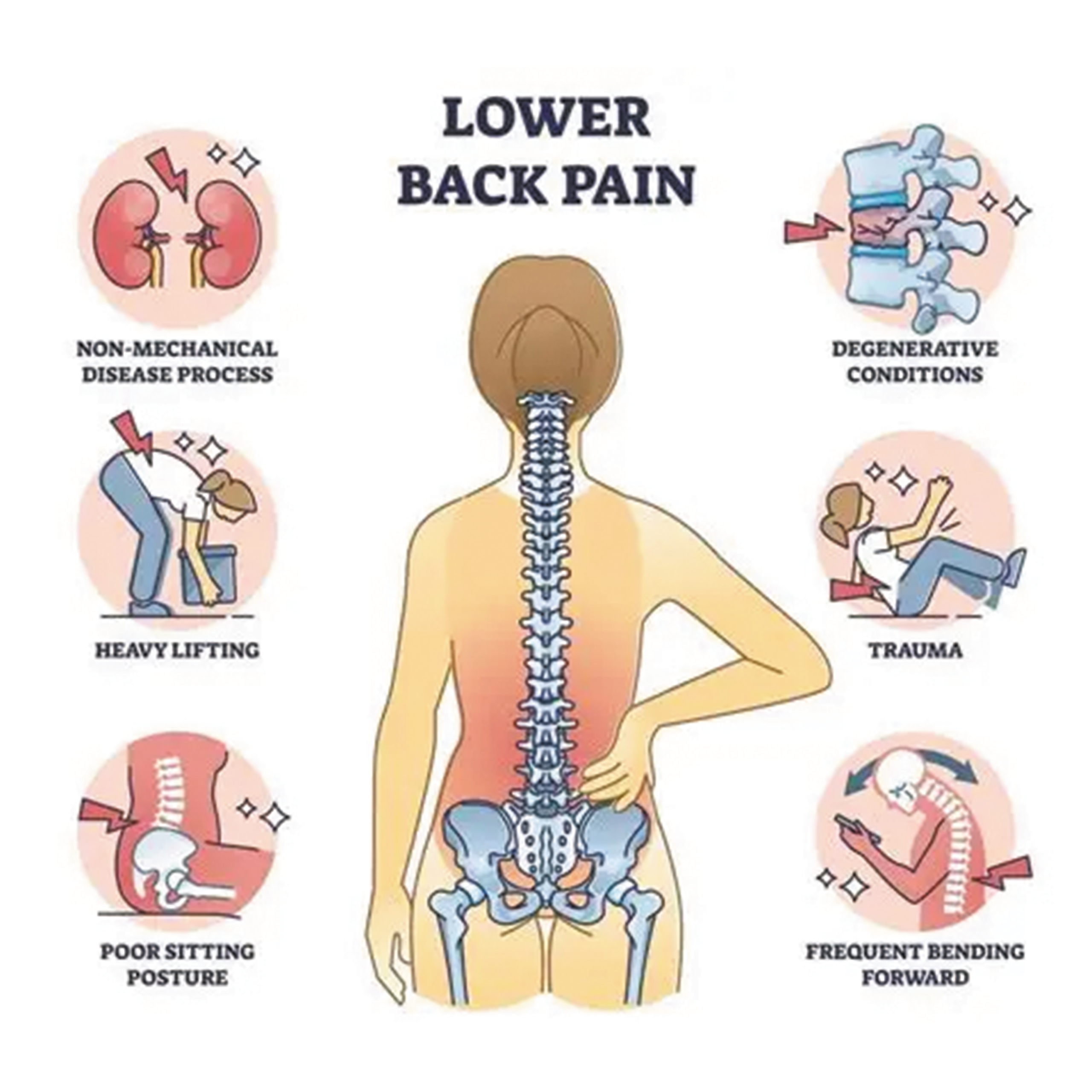 Low Back Pain Lecture Youngstown Ohio